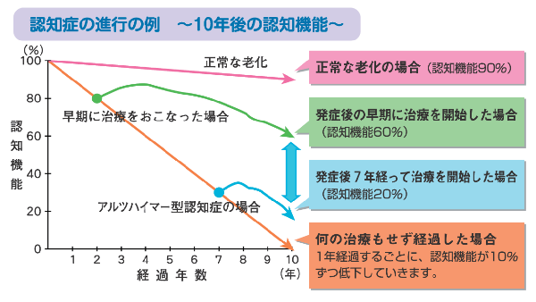 代表的な認知症であるアルツハイマー病の進行例